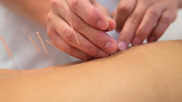 做埋线减肥后第六天可以汗蒸吗(图1) 做埋线减肥后第六天可以汗蒸吗