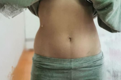 夏天减肥快还是冬天减肥快(图1) 夏天减肥快还是冬天减肥快